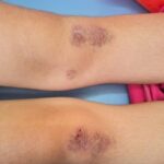 На Львівщині опікунка побила дівчат та змушувала стояти на гречці: розслідування