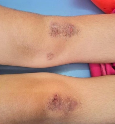 На Львівщині опікунка побила дівчат та змушувала стояти на гречці: розслідування