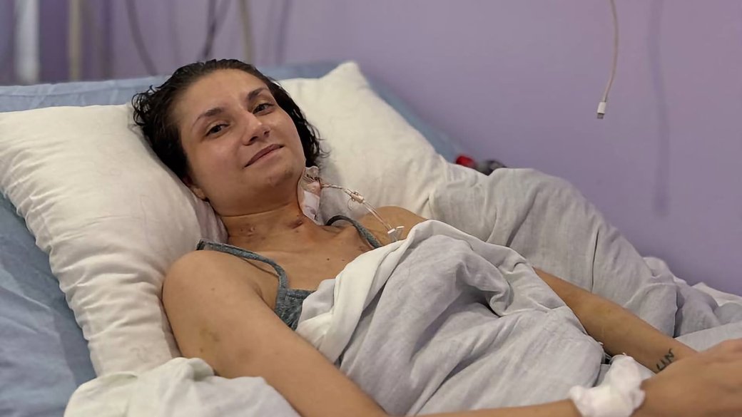 У Львові врятували 28-річну жінку з важкою формою пневмонії